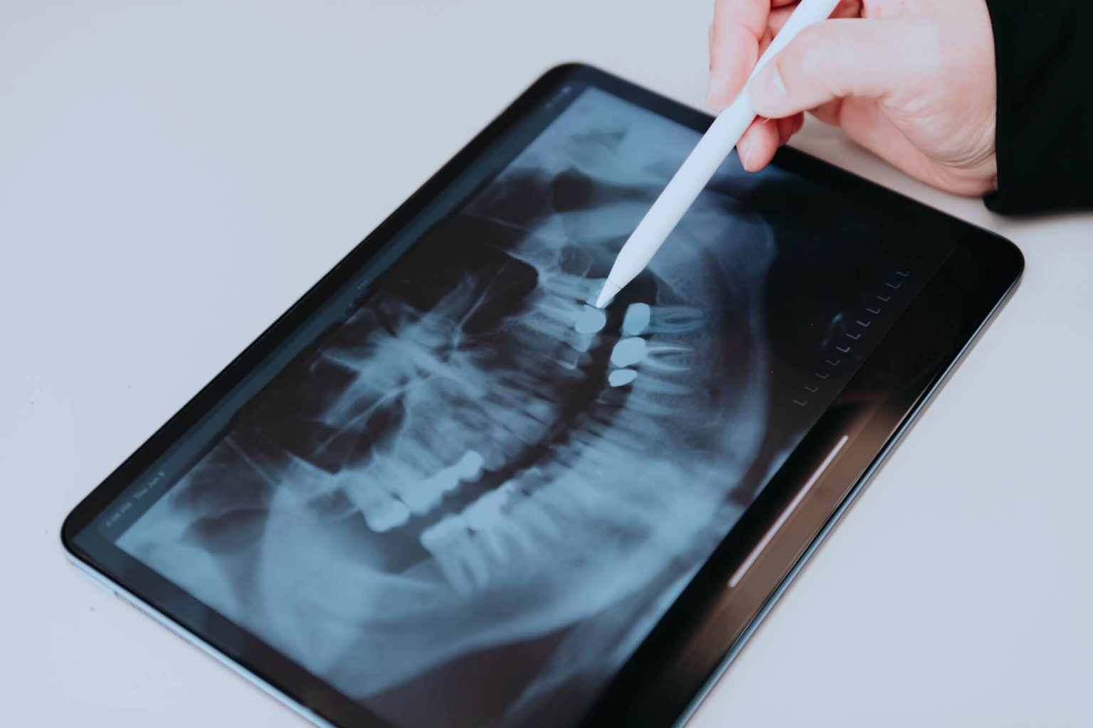 Cleborne Oral Surgeon analyzing dental images